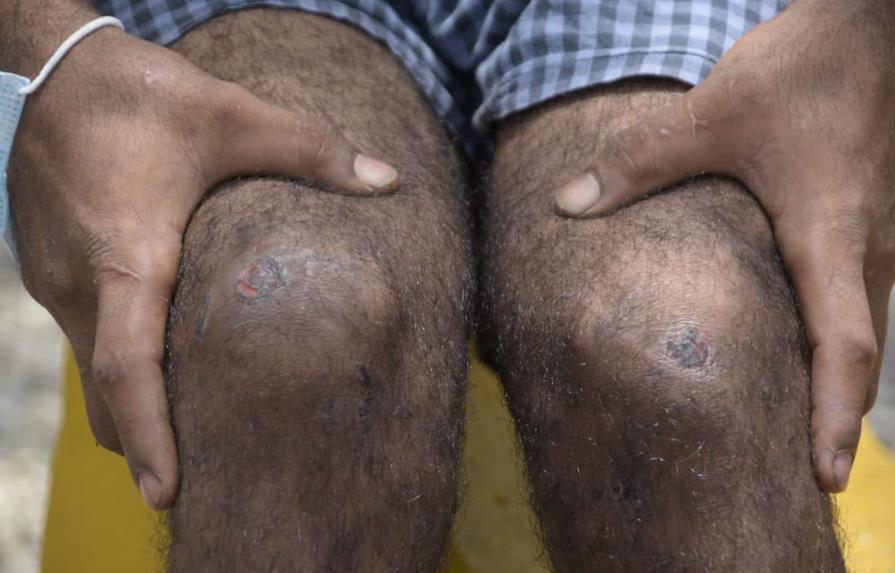 Padre de joven golpeado por agentes en Villas Agrícolas: No creo en la Policía Nacional Padre de joven golpeado por agentes en Villas Agrícolas: No creo en la Policía Nacional