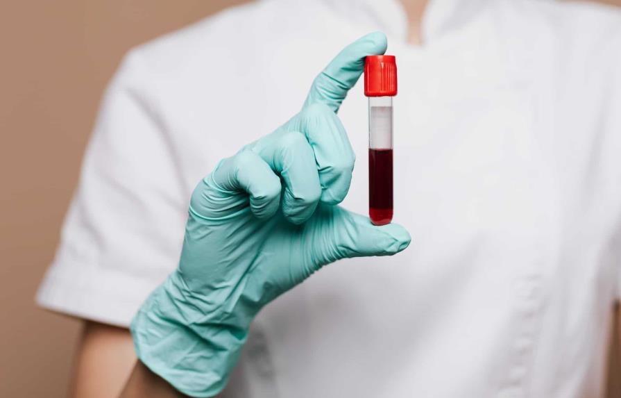 ¿Cuál es el tipo de sangre más común en República Dominicana? ¿Cuál es el tipo de sangre más común en República Dominicana?