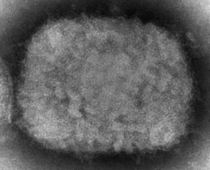 Antivirales podrían reducir la duración de los síntomas de viruela del mono Antivirales podrían reducir la duración de los síntomas de viruela del mono