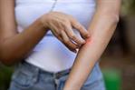¿Por qué los mosquitos pican más a unas personas que a otras? ¿Por qué los mosquitos pican más a unas personas que a otras?