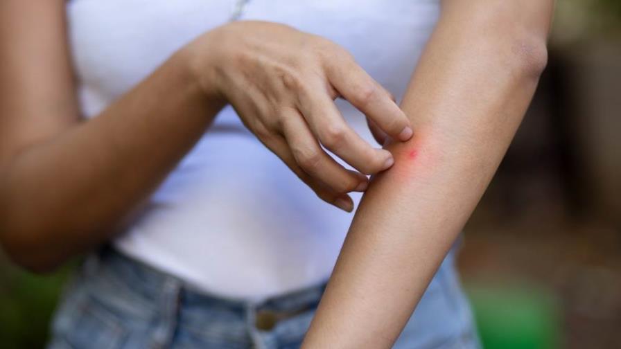 ¿Por qué los mosquitos pican más a unas personas que a otras?