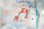 Nacimiento por cesárea, prematuridad y autismo Nacimiento por cesárea, prematuridad y autismo