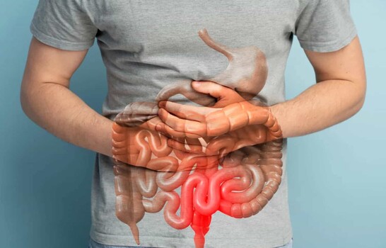 ¿Qué significa un diagnóstico de enfermedad inflamatoria intestinal?