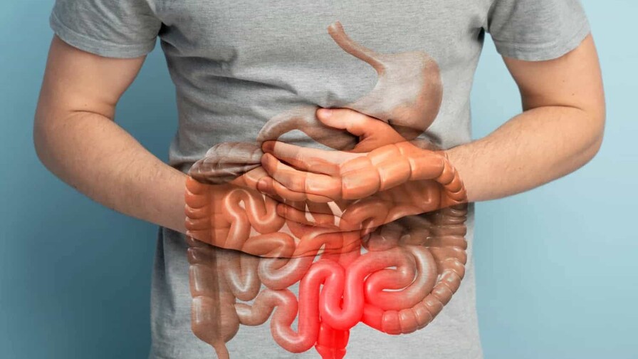 ¿Qué significa un diagnóstico de enfermedad inflamatoria intestinal?