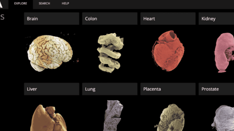 El google earth de los órganos permite una perspectiva inigualable del cuerpo humano