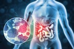El 10 % de los diagnósticos de cáncer de colon se hacen antes del paciente cumplir 50 años