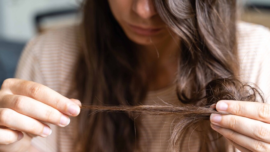 Más allá de la caída: lo que debes saber sobre la calvicie femenina Más allá de la caída: lo que debes saber sobre la calvicie femenina