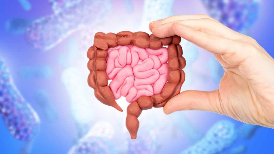 ¿Tus bacterias intestinales pueden aumentar el riesgo de piedras en los riñones?