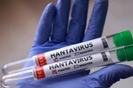 Argentina halla hantavirus en Tierra del Fuego sin nexo con brote del crucero Hondius
