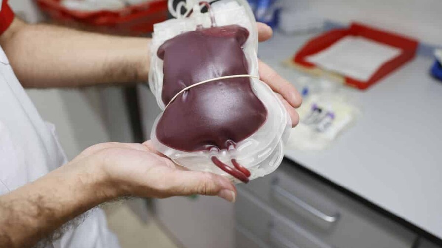 Transfusión de sangre: la de un familiar directo no es la mejor