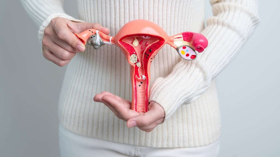 La endometriosis quizás no empiece en el útero