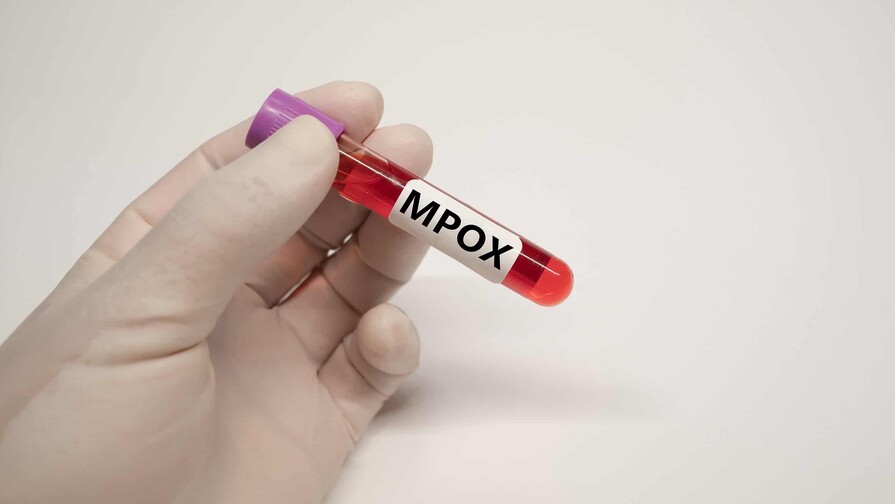 Qué pasa con la Viruela Símica (MPox) en la República Dominicana