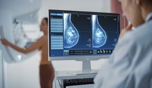 Programa de detección de cáncer de mama del Gobierno registra 113 casos y cinco muertas desde 2021