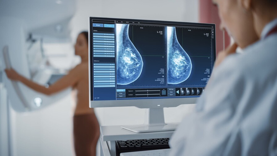 Programa de detección de cáncer de mama del Gobierno registra 113 casos y cinco muertas desde 2021