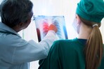 Cáncer pulmonar: la importancia del diagnóstico temprano 