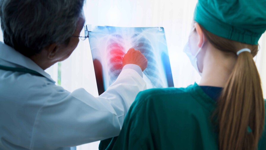 Cáncer pulmonar: la importancia del diagnóstico temprano Cáncer pulmonar: la importancia del diagnóstico temprano
